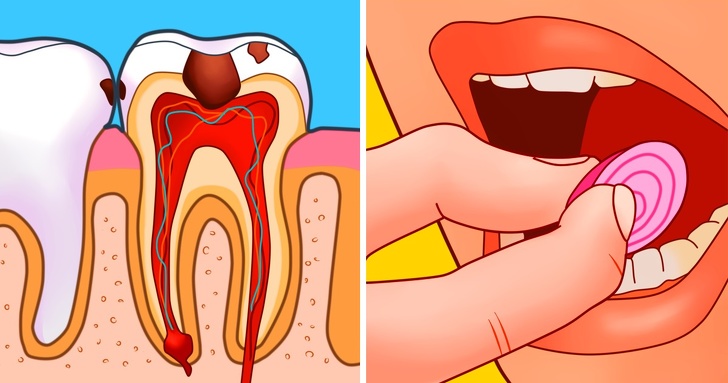 8 домашних средств, снимающих зубную боль