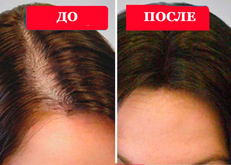 Чудо-средство от выпадения волос